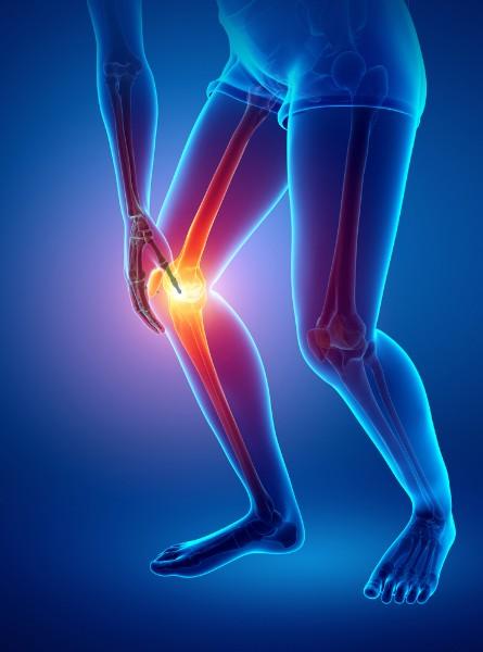 arthroscopie