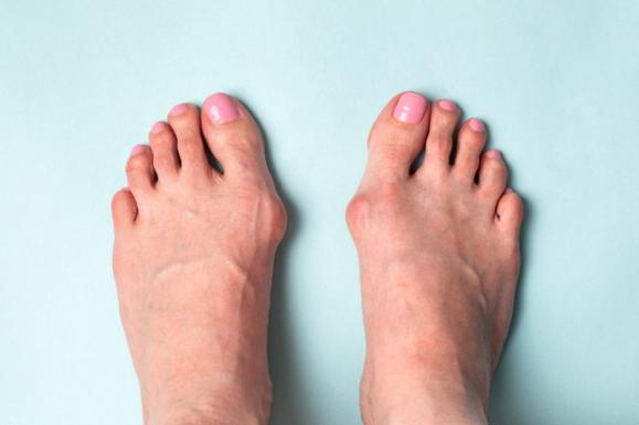 pathologie du pied